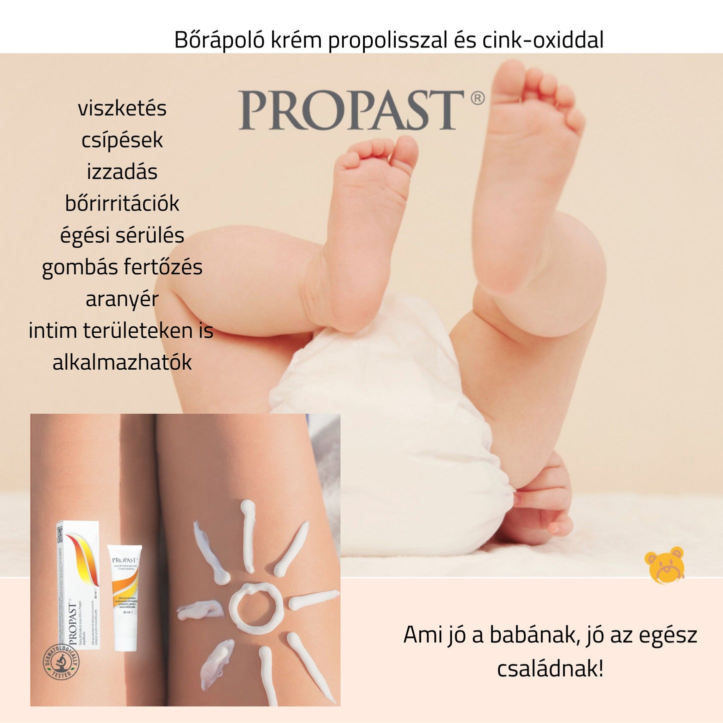 Propast kenőcs propolisszal és cink-oxiddal (popsikrém, csípések, égések, aranyér, felfekvés, bőrirritáció, gombás fertőzés) - 30ml